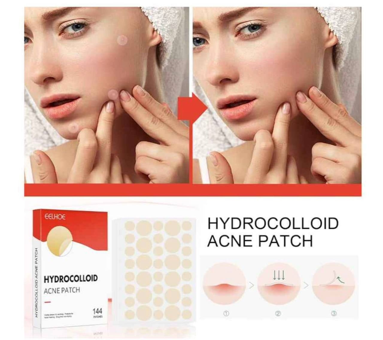 Parches Hidrocoloides Antiacne