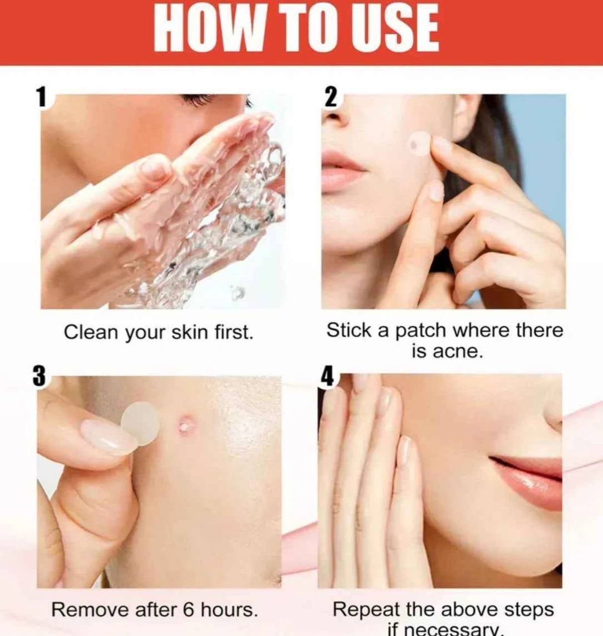 Parches Hidrocoloides Antiacne