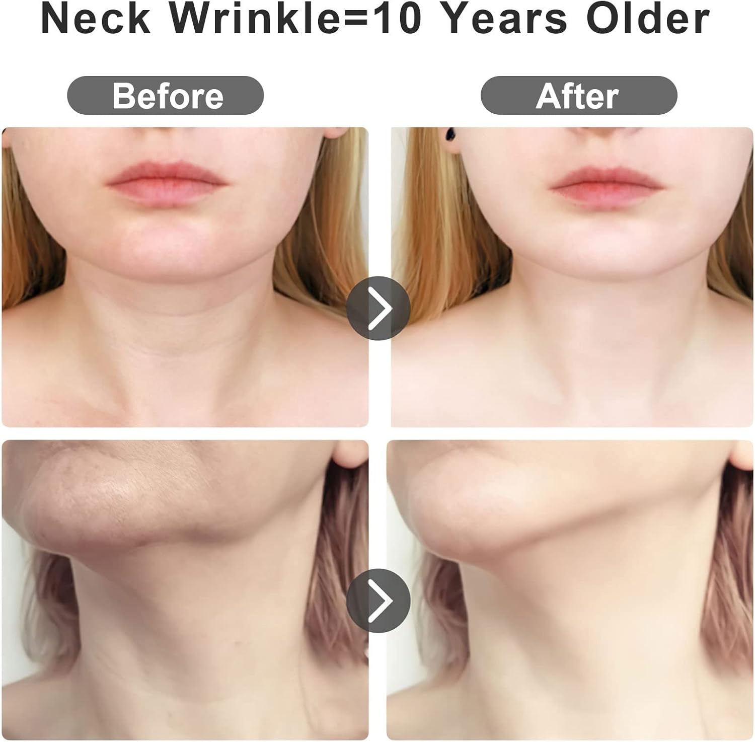 Masajeador Facial Ultrasonico